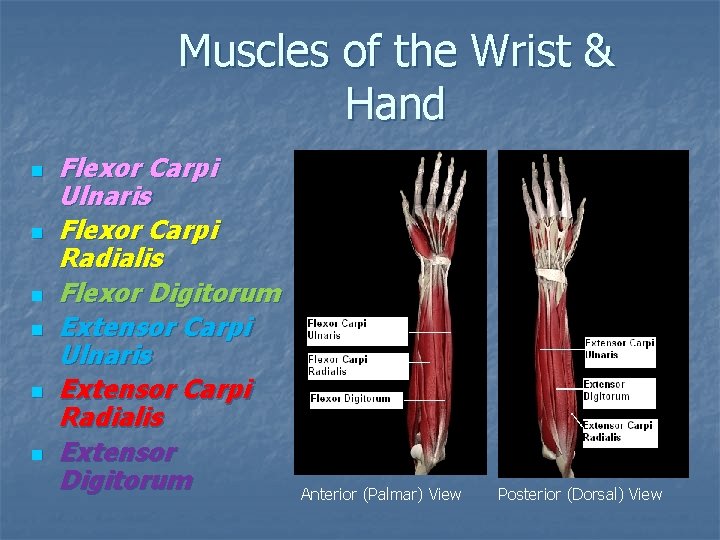 Muscles of the Wrist & Hand n n n Flexor Carpi Ulnaris Flexor Carpi