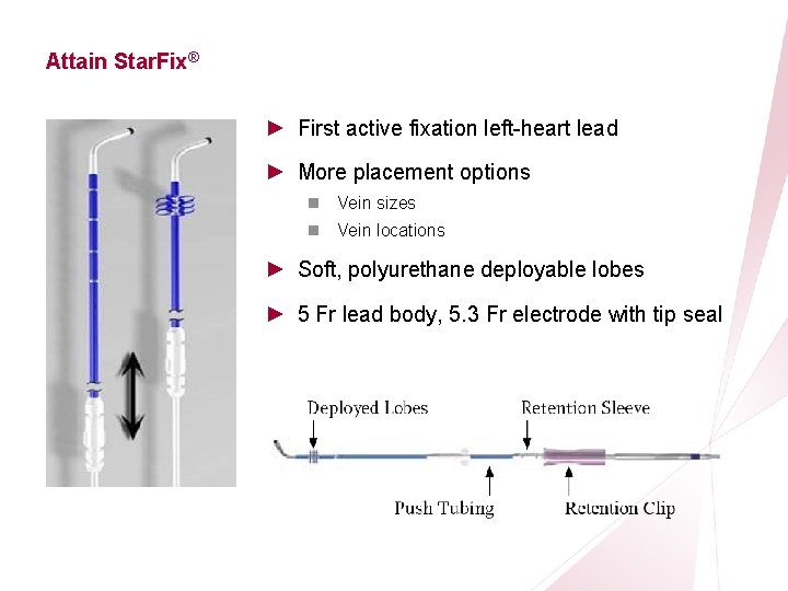 CRT Essentials Program Left-Heart Lead Implant Procedure Attain Star. Fix® ► First active fixation