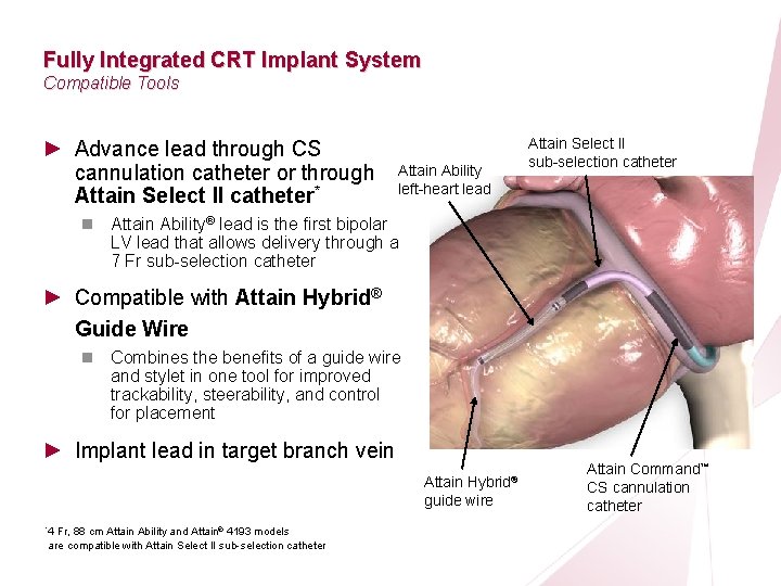 CRT Essentials Program Left-Heart Lead Implant Procedure Fully Integrated CRT Implant System Compatible Tools