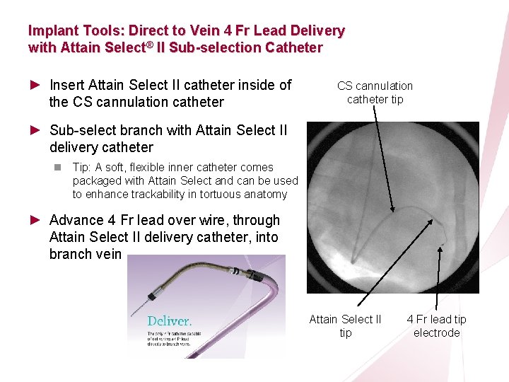 CRT Essentials Program Left-Heart Lead Implant Procedure Implant Tools: Direct to Vein 4 Fr