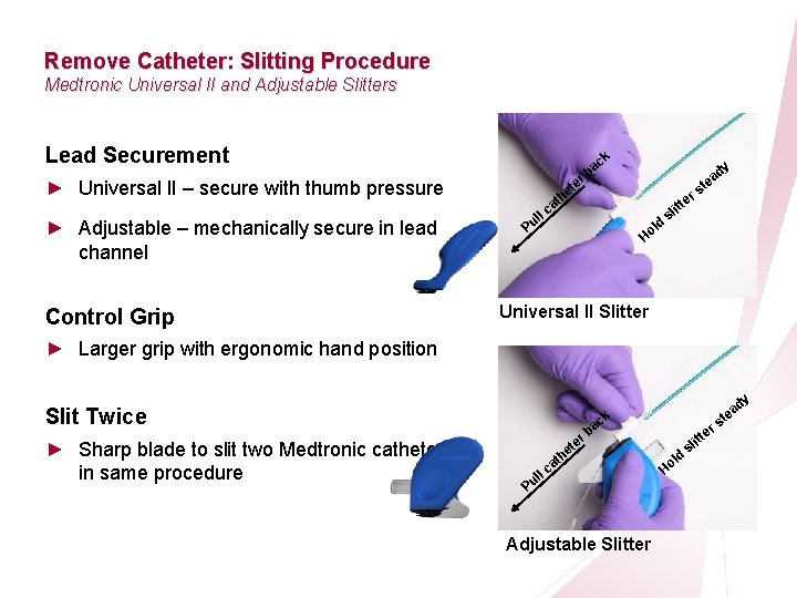 CRT Essentials Program Left-Heart Lead Implant Procedure Remove Catheter: Slitting Procedure Medtronic Universal II