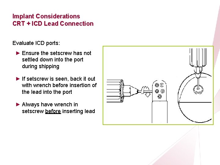 CRT Essentials Program Implant Considerations CRT + ICD Lead Connection Evaluate ICD ports: ►