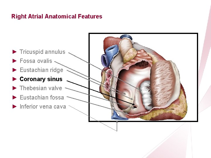 CRT Essentials Program Right Atrial Anatomical Features ► Tricuspid annulus ► Fossa ovalis ►