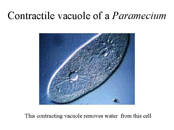 Contractile vacuole of a Paramecium This contracting vacuole removes water from this cell 
