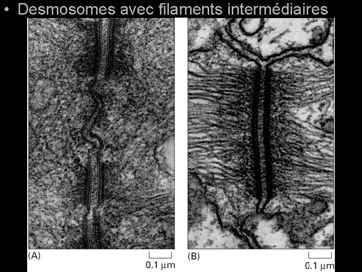 • Desmosomes avec filaments intermédiaires Fig 19 -11(A-B) • Desmosomes avec filaments intermédiaires Fig 19 -11(A-B)