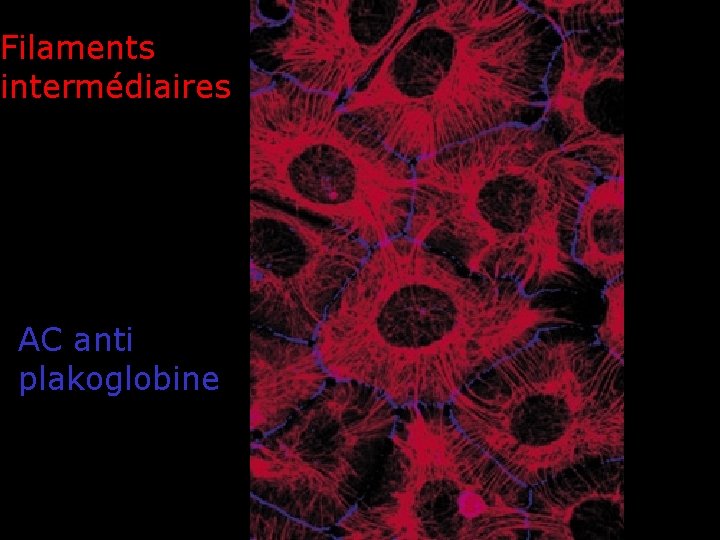 Filaments intermédiaires Nature Rev Mol Cell Biol AC anti plakoglobine Filaments intermédiaires Nature Rev Mol Cell Biol AC anti plakoglobine
