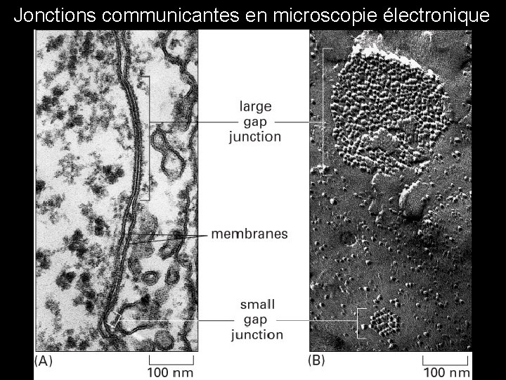 Jonctions communicantes en microscopie électronique Fig 19 -16 Jonctions communicantes en microscopie électronique Fig 19 -16