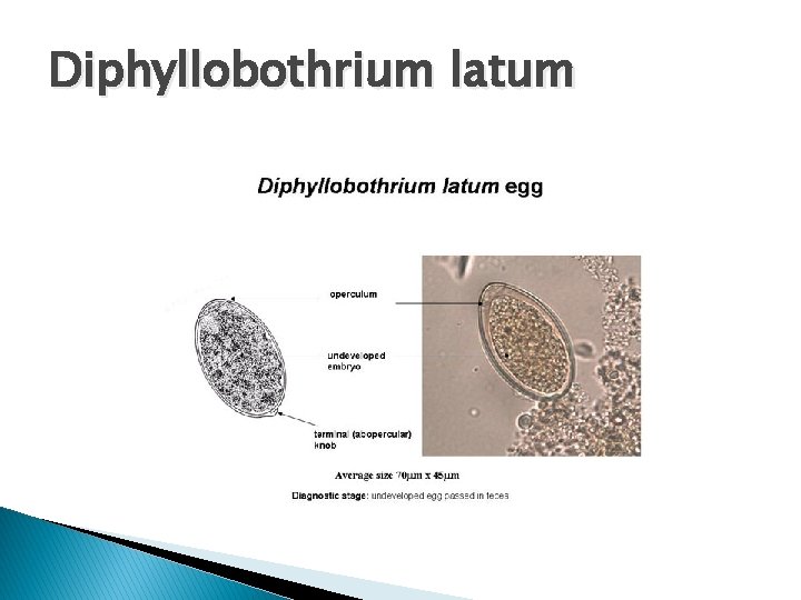 Diphyllobothrium latum 