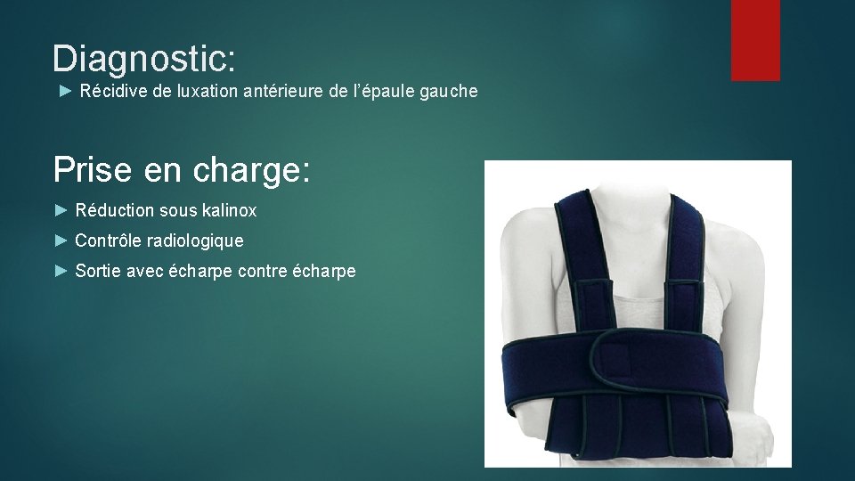 Luxations Glnohumrales Collignon Maxime Dallalba Aurlia Fasm 2