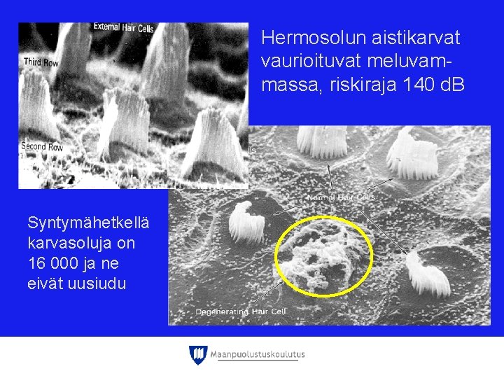 Hermosolun aistikarvat vaurioituvat meluvammassa, riskiraja 140 d. B Syntymähetkellä karvasoluja on 16 000 ja Hermosolun aistikarvat vaurioituvat meluvammassa, riskiraja 140 d. B Syntymähetkellä karvasoluja on 16 000 ja