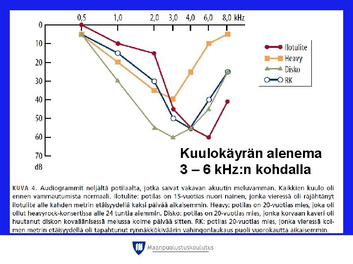 Kuulokäyrän alenema 3 – 6 k. Hz: n kohdalla Kuulokäyrän alenema 3 – 6 k. Hz: n kohdalla