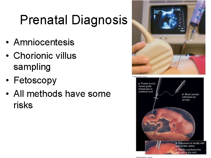 Prenatal Diagnosis • Amniocentesis • Chorionic villus sampling • Fetoscopy • All methods have
