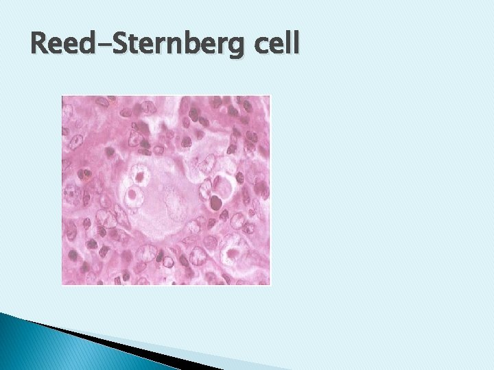 Reed-Sternberg cell Reed-Sternberg cell