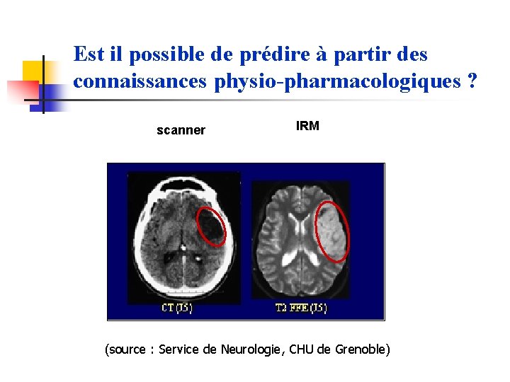 Est il possible de prédire à partir des connaissances physio-pharmacologiques ? scanner IRM (source