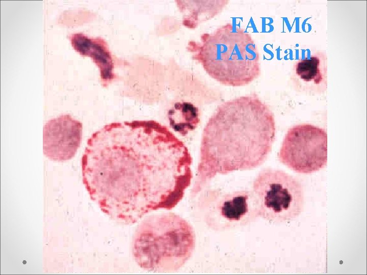 FAB M 6 PAS Stain 