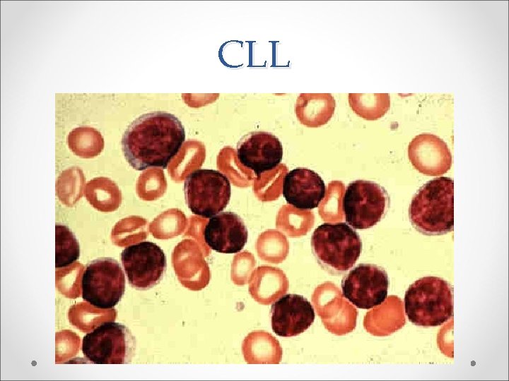 CLL 