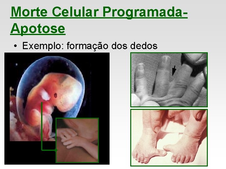 Morte Celular Programada. Apotose • Exemplo: formação dos dedos 
