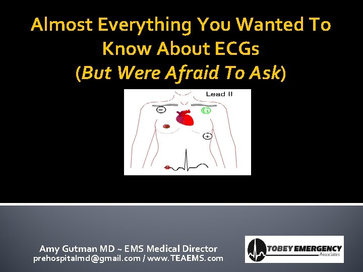 Almost Everything You Wanted To Know About ECGs (But Were Afraid To Ask) Amy