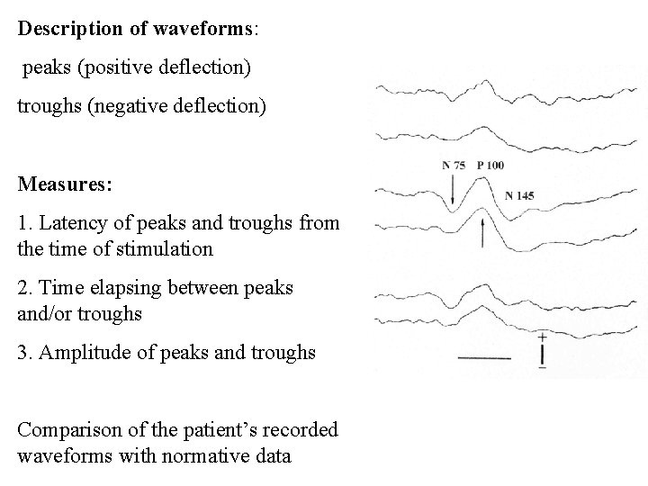Description of waveforms: peaks (positive deflection) troughs (negative deflection) Measures: 1. Latency of peaks