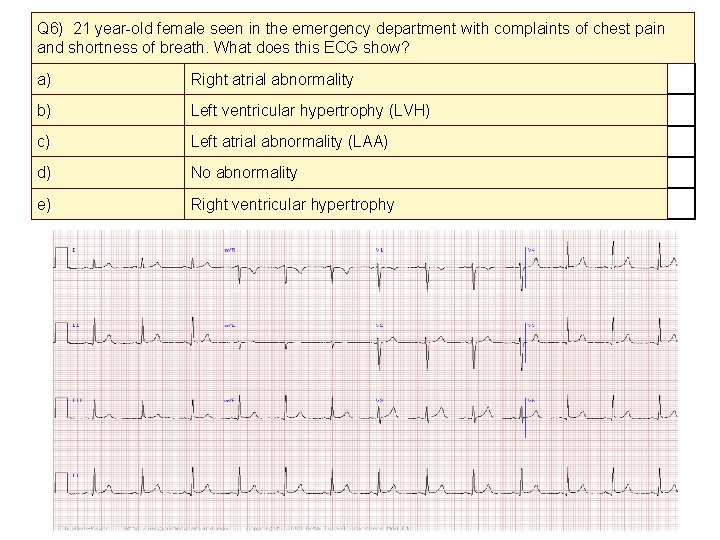 Q 6) 21 year-old female seen in the emergency department with complaints of chest