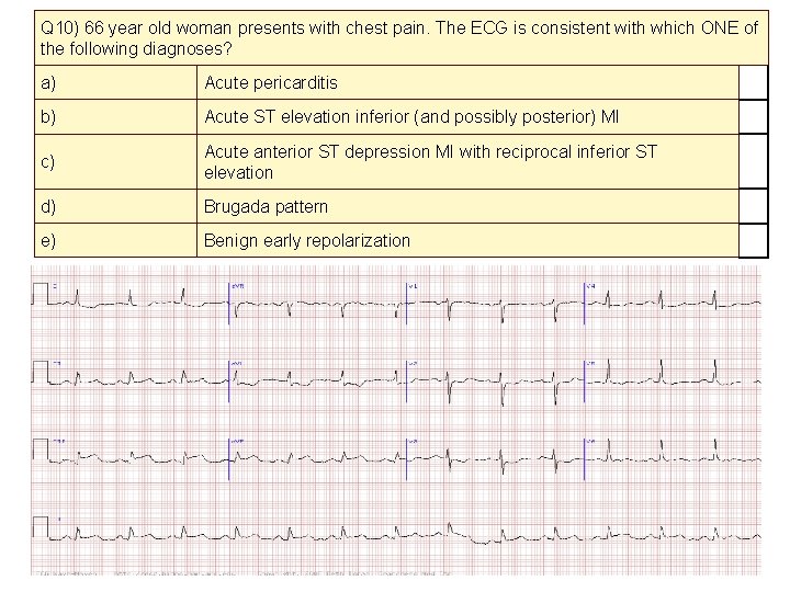Q 10) 66 year old woman presents with chest pain. The ECG is consistent