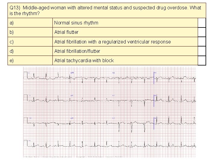 Q 13) Middle-aged woman with altered mental status and suspected drug overdose. What is