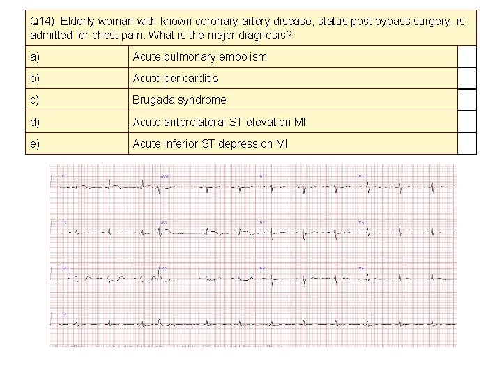 Q 14) Elderly woman with known coronary artery disease, status post bypass surgery, is