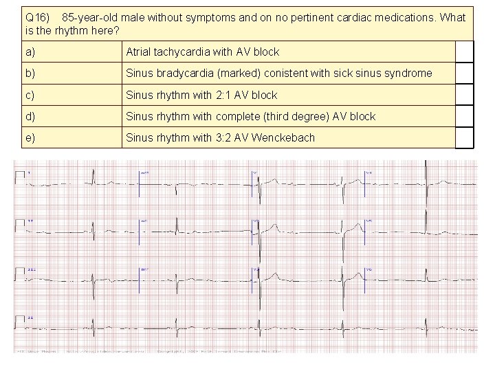 Q 16) 85 -year-old male without symptoms and on no pertinent cardiac medications. What