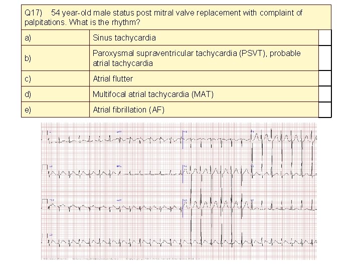 Q 17) 54 year-old male status post mitral valve replacement with complaint of palpitations.