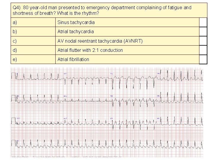 Q 4) 80 year-old man presented to emergency department complaining of fatigue and shortness