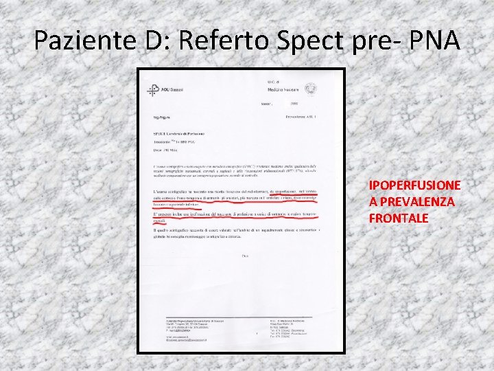 Paziente D: Referto Spect pre- PNA IPOPERFUSIONE A PREVALENZA FRONTALE 