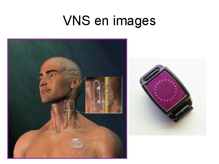 VNS en images 