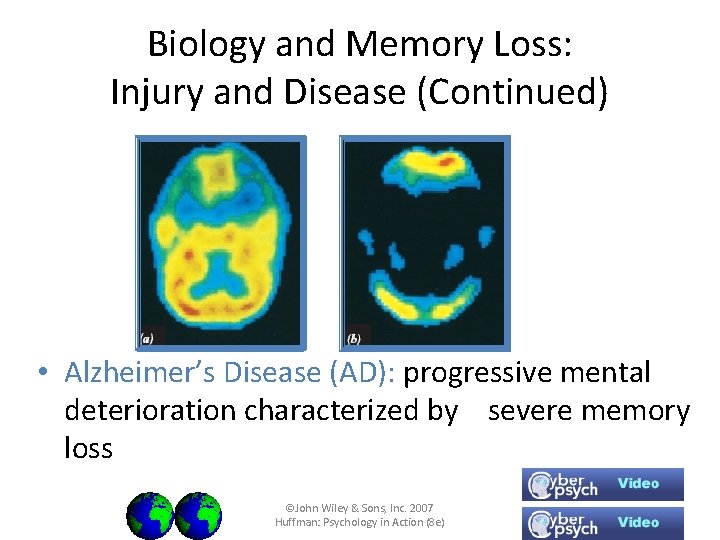 Biology and Memory Loss: Injury and Disease (Continued) • Alzheimer’s Disease (AD): progressive mental
