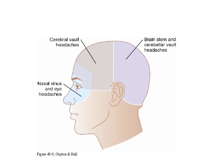 Origin of Headache Pain Figure 48 -9; Guyton & Hall 