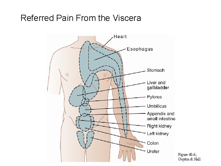 Referred Pain From the Viscera Figure 48 -6; Guyton & Hall 