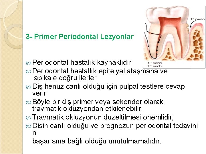 3 - Primer Periodontal Lezyonlar Periodontal hastalık kaynaklıdır hastallık epitelyal ataşmana ve apikale doğru