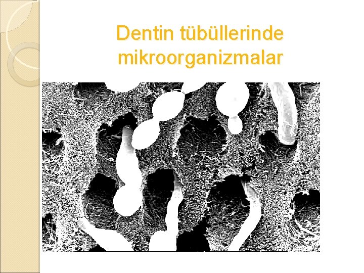 Dentin tübüllerinde mikroorganizmalar 