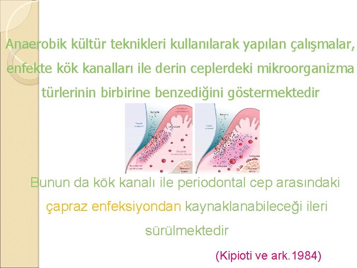 Anaerobik kültür teknikleri kullanılarak yapılan çalışmalar, enfekte kök kanalları ile derin ceplerdeki mikroorganizma türlerinin