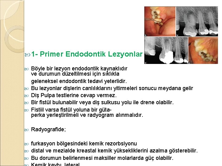  1 Primer Endodontik Lezyonlar Böyle bir lezyon endodontik kaynaklıdır ve durumun düzeltilmesi için