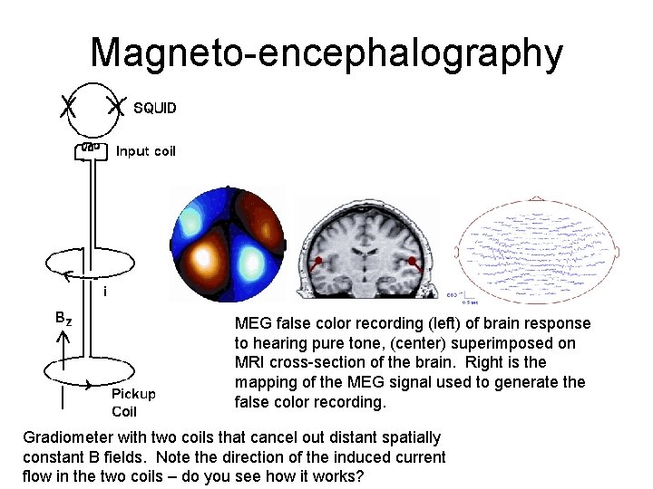 Magneto-encephalography MEG false color recording (left) of brain response to hearing pure tone, (center)
