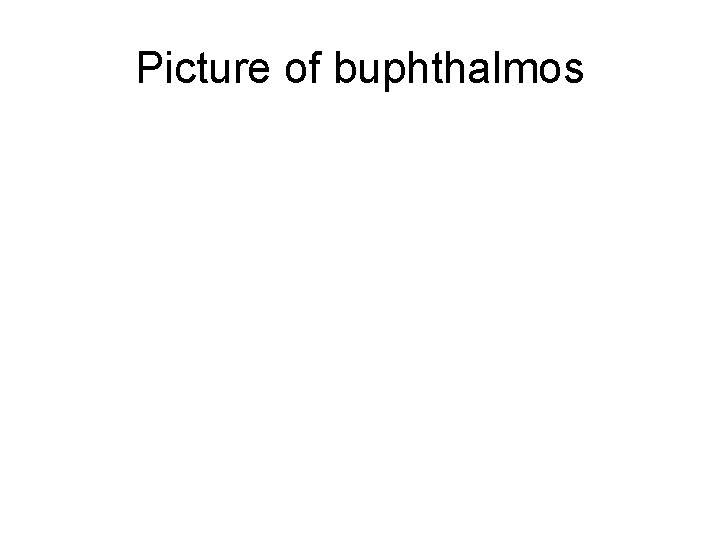 Picture of buphthalmos 