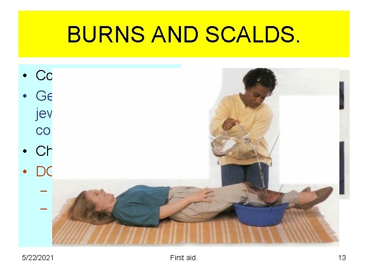 BURNS AND SCALDS. • Cold water flushing. • Gently remove, jewellery, belt, watch, constricting BURNS AND SCALDS. • Cold water flushing. • Gently remove, jewellery, belt, watch, constricting