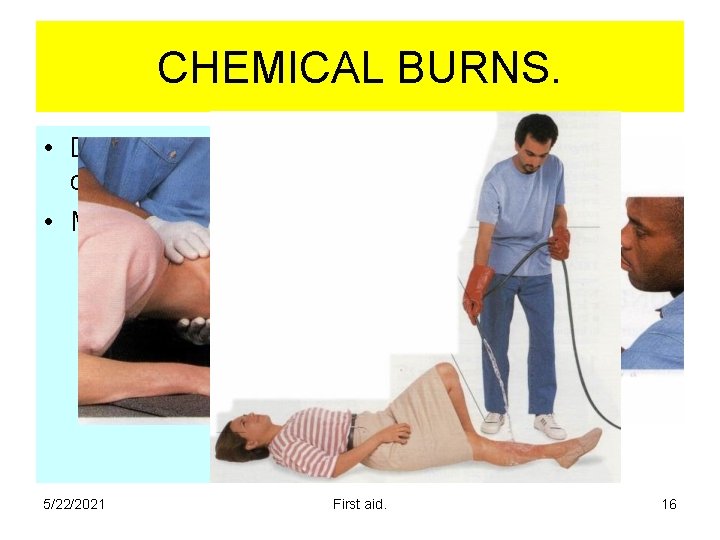 CHEMICAL BURNS. • Disperse harmful chemical. • Make the area safe. 5/22/2021 First aid. CHEMICAL BURNS. • Disperse harmful chemical. • Make the area safe. 5/22/2021 First aid.
