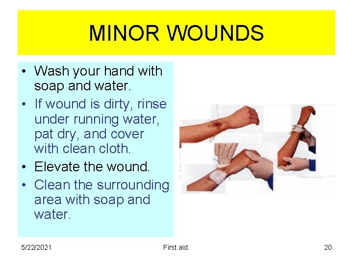 MINOR WOUNDS • Wash your hand with soap and water. • If wound is MINOR WOUNDS • Wash your hand with soap and water. • If wound is