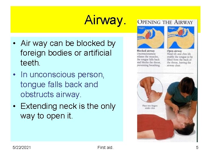 Airway. • Air way can be blocked by foreign bodies or artificial teeth. • Airway. • Air way can be blocked by foreign bodies or artificial teeth. •