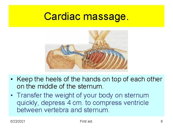 Cardiac massage. • Keep the heels of the hands on top of each other Cardiac massage. • Keep the heels of the hands on top of each other