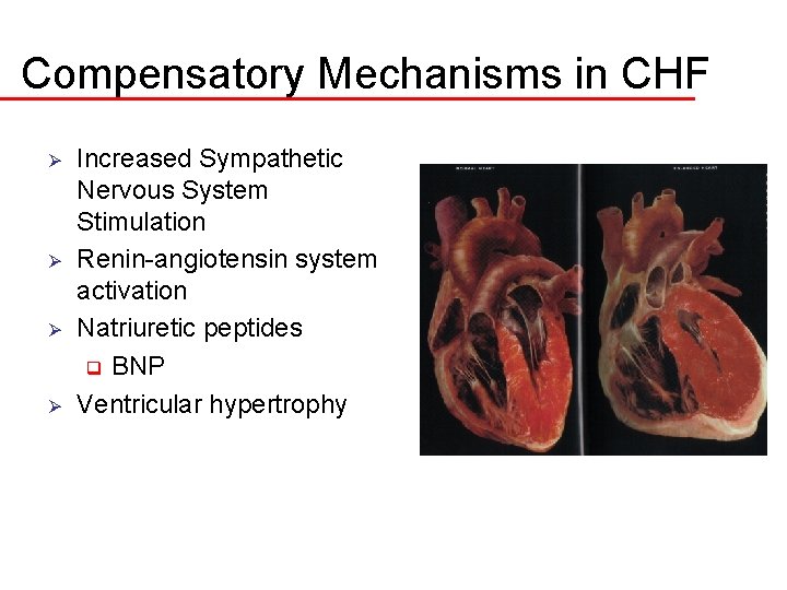 Compensatory Mechanisms in CHF Ø Ø Increased Sympathetic Nervous System Stimulation Renin-angiotensin system activation
