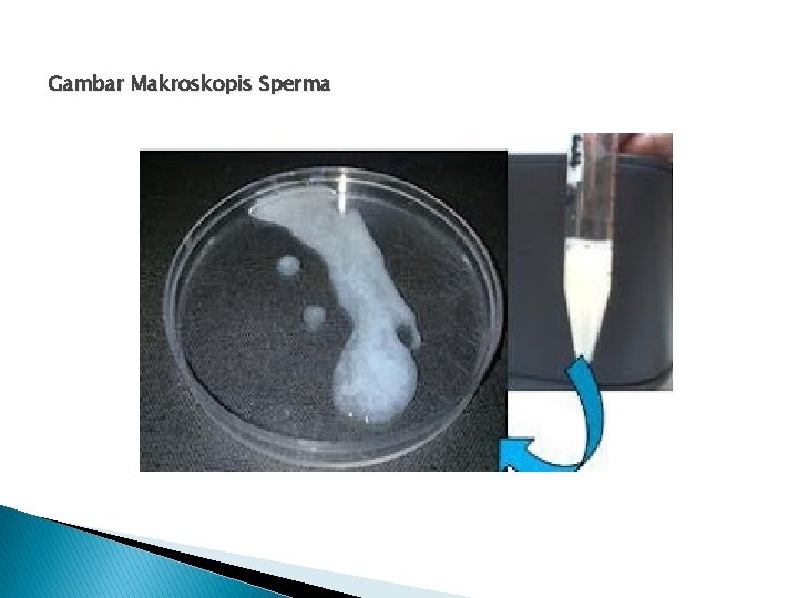 Gambar Makroskopis Sperma 