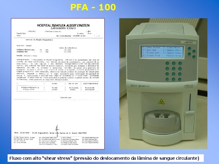 PFA - 100 Fluxo com alto “shear stress” (pressão do deslocamento da lâmina de