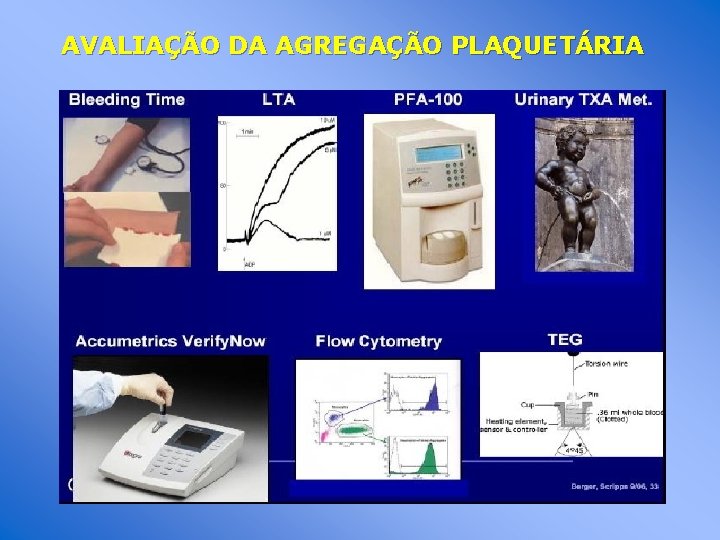 AVALIAÇÃO DA AGREGAÇÃO PLAQUETÁRIA 